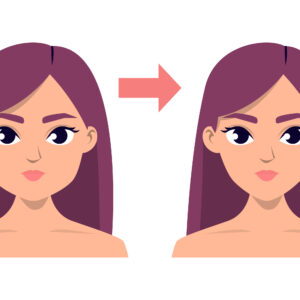 Face,Contour,Plastic,Surgery,Vector,Isolated.,V-line,Jaw,Reduction.,Beauty