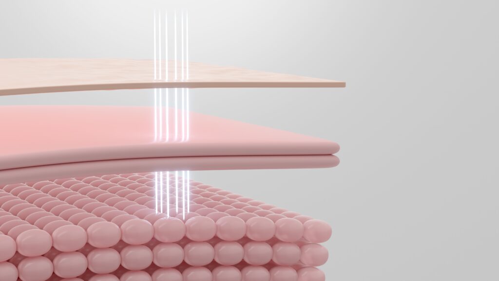 고주파 리프팅은 피부 겉이 아닌 진피층을 중심으로 자극을 전달해 콜라겐 재생을 유도하여 열 에너지를 고르게 전달