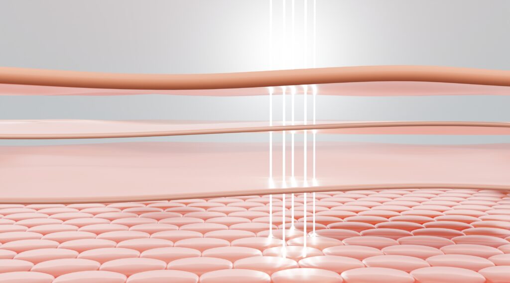 울쎄라리프라임은 피부 깊은 층인 SMAS층을 정확히 타깃으로 하면서도, 주변 조직에 일정하고 균일한 열 에너지를 전달해 피부 스스로 콜라겐 재생을 촉진