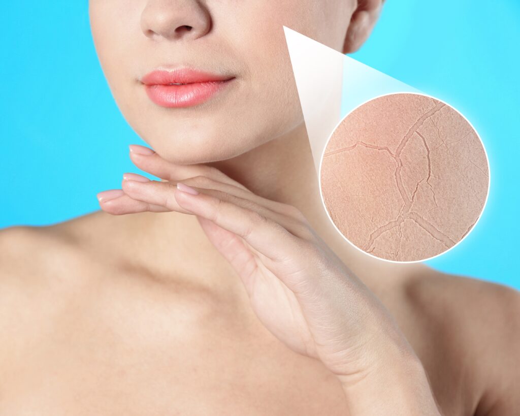 건조한 날씨로 인해 푸석해진 피부