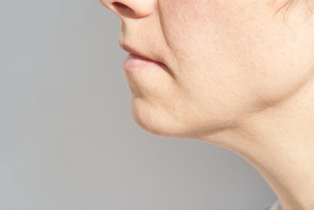 탄력을 잃으면 홍대 마인드피부과에서 리프팅 시술이 필요할 수 있습니다.