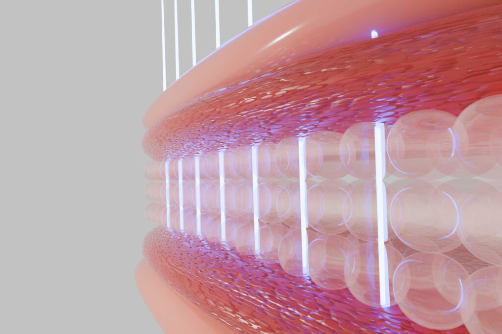홍대 마인드피부과 시술 주기