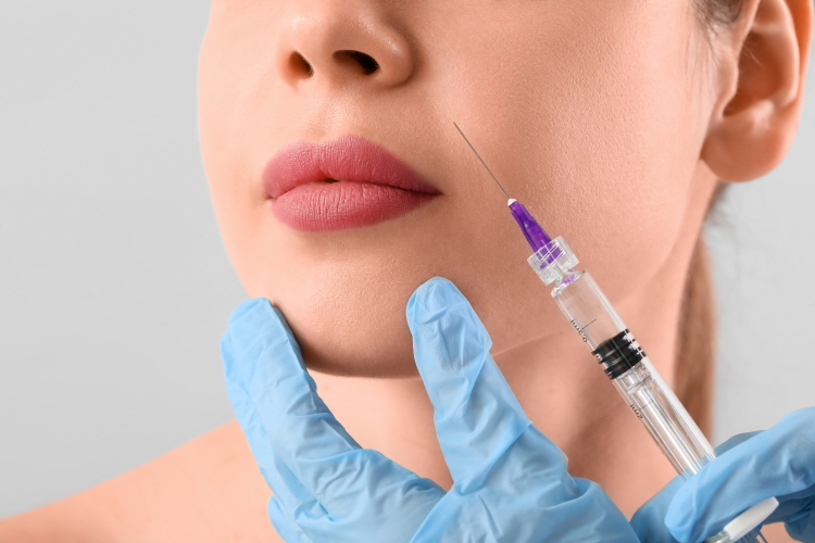 홍대 마인드피부과 레스틸렌 비탈 시술 주기