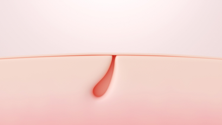 홍대 마인드피부과 포텐자는 재생 과정에 자극을 주어 피부가 스스로 회복하는 흐름을 돕는 방식이다