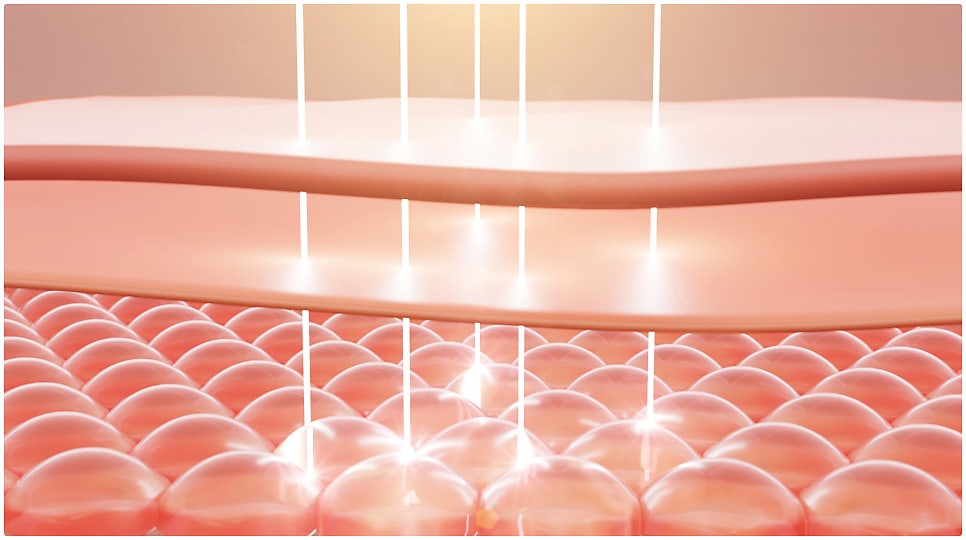 피부 구조의 변화를 이해하고 현재 피부 상태에 맞는 관리 방법을 고려한 후 홍대 마인드피부과 시술을 진행하는것이 중요하다.